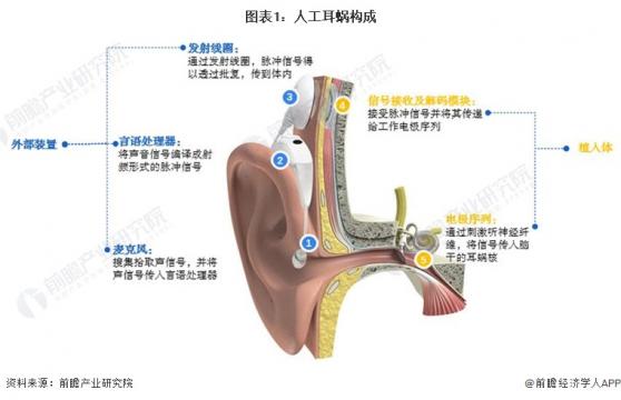 预见2024：《2024年中国人工耳蜗行业全景图谱》(附市场规模、竞争格局和发展前景等)